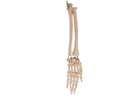 Palmen-Ellbogen-Gelenk-Anatomie-Radialknochen für medizinisches Training