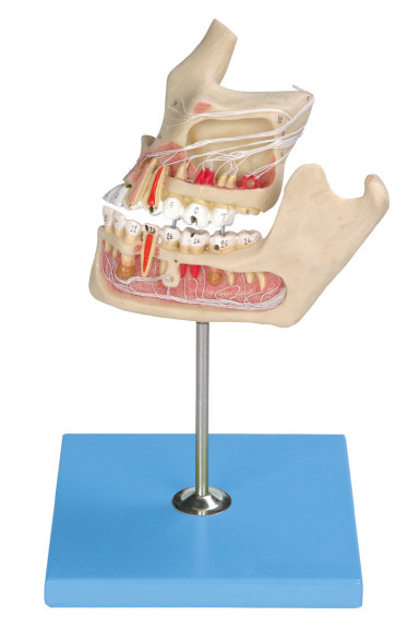 Pathologisches menschliches Zahn-Modell/Kiefer-Modell mit der Farbe, die durch Computer über zwei Teile zusammenpaßt