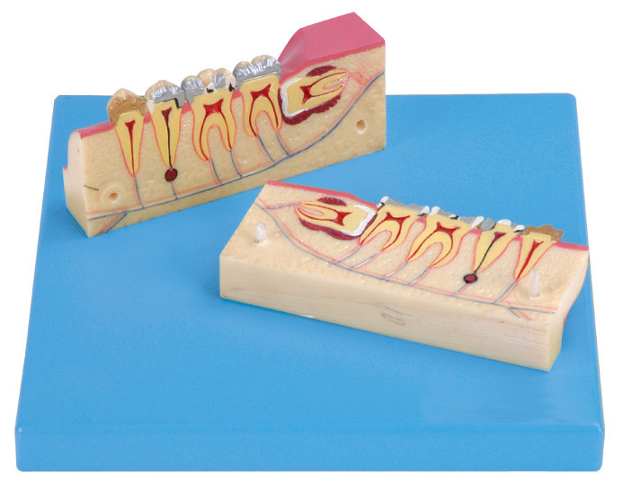 12 Positionen werden von Dissected Modell des Zahn-Gewebes angezeigt