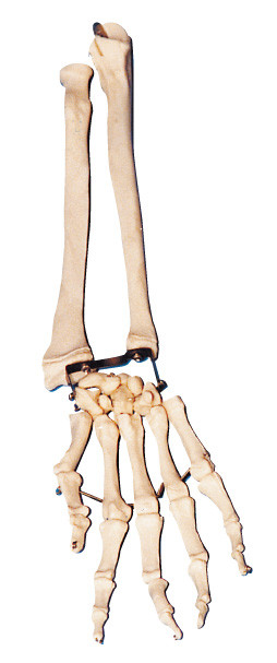 Palmen-Knochen mit Ellbogen - Knochen und Radialknochen bewaffnen vorbildliches Trainingswerkzeug der Anatomie