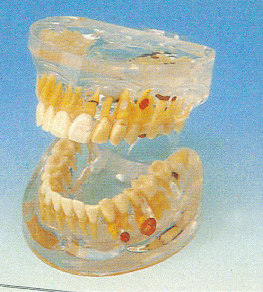 Erwachsene transparente zahnmedizinische Pathologie-menschliches Zahn-Modell für die College-Ausbildung