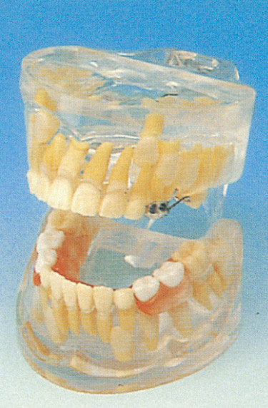 Zahnmedizinische Schulmenschliches Zahn-Modell/transparentes Milch-Zahn-Entwicklungs-Modell