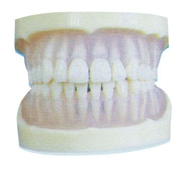 Transparentes PET Zahn-Standardmodell für die zahnmedizinische College-Ausbildung