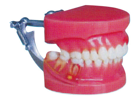Rote und weiße Parodontalerkrankungs-Demonstrations-menschliche Zahn-vorbildlicher General Doktor