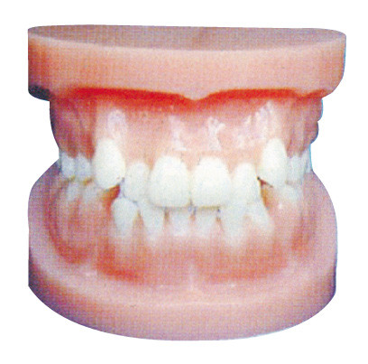 Zahnimplantat modelliert,/orthodontisches Modell für anatomisches Training