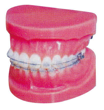 Normales örtlich festgelegtes orthodontisches Modell für die Krankenhaus-und der Medizinischen Fakultäten Ausbildung