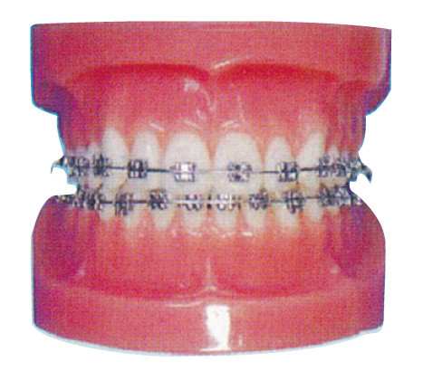 Orthodontisches menschliches Zahn-Modell für Krankenhäuser und zahnmedizinisches Krankenhaus-Training