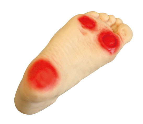 Fuß-Krankenpflegesimulator PVCs zuckerkranker von den pathologischen Änderungen des Fußes verursacht durch Diabetes