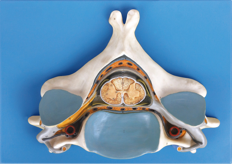 Fünftes zervikales Vertrebra mit anatomischem menschlichem skeleton Modell des Rückenmarks und des Nervs