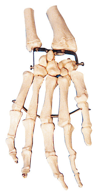 Palmen-Knochen-menschliches Anatomiemodell-Trainingsmodell für Medizinische Fakultät
