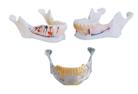 Zahnarztzähne modellieren mandibulares Modell mit den Nerven, den Arterien und den Adern