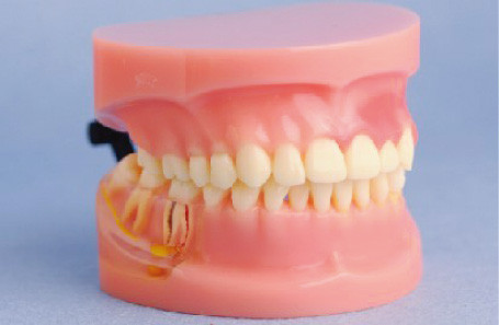 Modell Parodontalerkrankungs-des menschlichen Zahn-Modells für medizinische Colleges und Klinik-Training