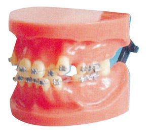 Verschiebungs-örtlich festgelegtes orthodontisches Modell für medizinisches College und zahnmedizinisches Krankenhaus-Training
